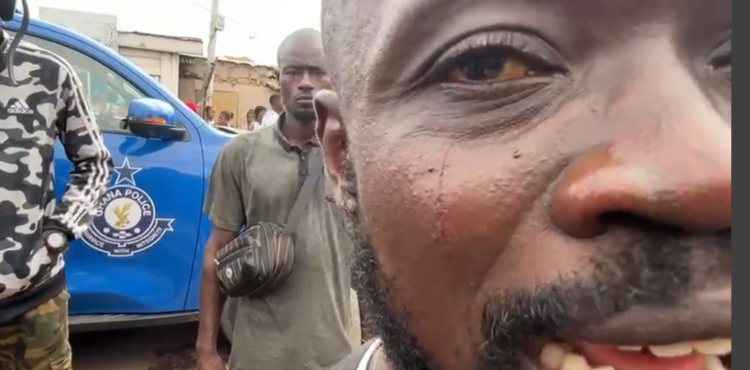 Ghana Police interdicts policeman who assaulted a journalist